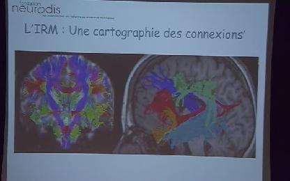 Cartes corticales : une représentation objective et dynamique de la réalité ? 